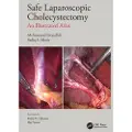 Taylor & Francis Ltd Safe Laparoscopic Cholecystectomy