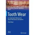 Springer Nature Tooth Wear