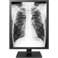 LG Medical Diagnostic 3mp Skjerm 60hz
