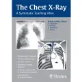 Thieme The Chest X-Ray