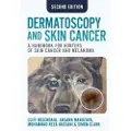 SCION PUBLISHING LTD Dermatoscopy and Skin Cancer, second edition