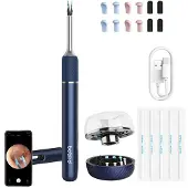 Bebird Smart Visual Ear-Clean Rod Note 5 pro (blue)
